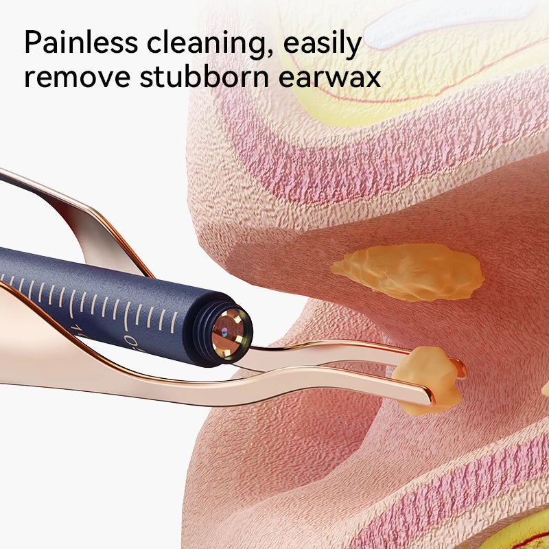ClearEar Pro — HD Camera Ear Cleaner