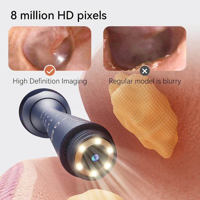 ClearEar Pro — HD Camera Ear Cleaner